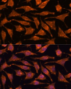 Invitrogen ABHD4 Polyclonal Antibody 100 &mu;L; Unconjugated:Antibodies,