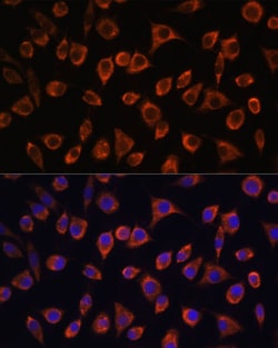Invitrogen MRPL43 Polyclonal Antibody 100 &mu;L; Unconjugated:Antibodies,