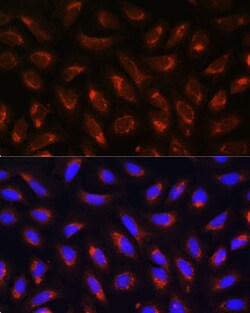 Invitrogen MRPL43 Polyclonal Antibody 100 &mu;L; Unconjugated:Antibodies,