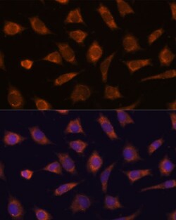Invitrogen CAMSAP1 Polyclonal Antibody 100 μL; Unconjugated:Antibodies,