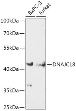 Invitrogen DJC18 Polyclonal Antibody 100 &mu;L; Unconjugated:Antibodies,