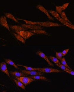 Invitrogen ARHGAP30 Polyclonal Antibody 100 &mu;L; Unconjugated:Antibodies,