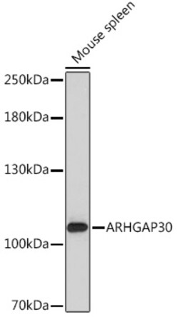 Invitrogen ARHGAP30 Polyclonal Antibody 100 &mu;L; Unconjugated:Antibodies,