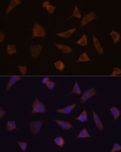 Invitrogen ENAH Polyclonal Antibody 100 &mu;L; Unconjugated:Antibodies,