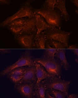 Invitrogen ENAH Polyclonal Antibody 100 &mu;L; Unconjugated:Antibodies,