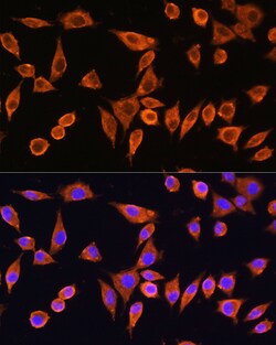 Invitrogen RPS28 Polyclonal Antibody 100 &mu;L; Unconjugated:Antibodies,