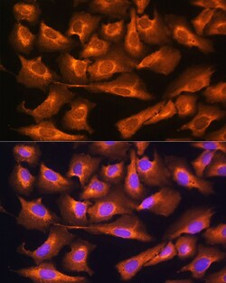 Invitrogen RPS28 Polyclonal Antibody 100 &mu;L; Unconjugated:Antibodies,