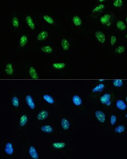 Invitrogen DHX9 Polyclonal Antibody 100 &mu;L; Unconjugated:Antibodies,