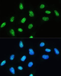 Invitrogen DHX9 Polyclonal Antibody 100 &mu;L; Unconjugated:Antibodies,