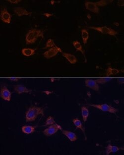 MT-ATP6 Polyclonal Antibody, Invitrogen 100 &mu;L; Unconjugated:Antibodies,