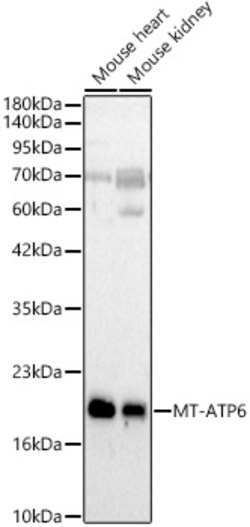 MT-ATP6 Polyclonal Antibody, Invitrogen 100 &mu;L; Unconjugated:Antibodies,