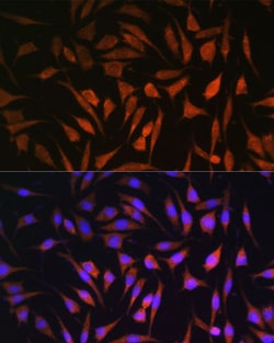Invitrogen RALGDS Polyclonal Antibody 100 &mu;L; Unconjugated:Antibodies,