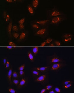 Invitrogen RALGDS Polyclonal Antibody 100 &mu;L; Unconjugated:Antibodies,