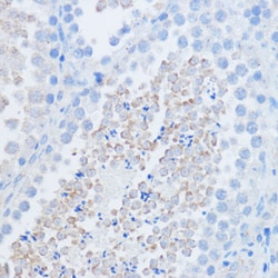 Invitrogen RALGDS Polyclonal Antibody 100 &mu;L; Unconjugated:Antibodies,