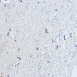 Invitrogen RALGDS Polyclonal Antibody 100 &mu;L; Unconjugated:Antibodies,