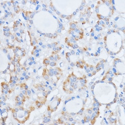 Invitrogen RALGDS Polyclonal Antibody 100 &mu;L; Unconjugated:Antibodies,