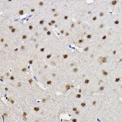 FOXO1/FOXO3/FOXO4 Polyclonal Antibody, Invitrogen&trade;