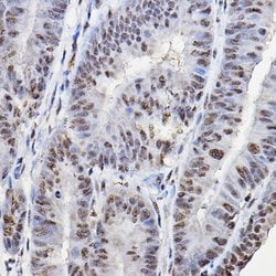 FOXO1/FOXO3/FOXO4 Polyclonal Antibody, Invitrogen&trade;