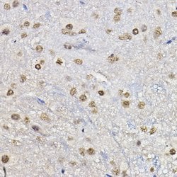 FOXO1/FOXO3/FOXO4 Polyclonal Antibody, Invitrogen&trade;