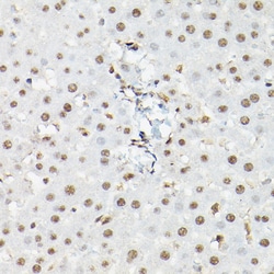 FOXO1/FOXO3/FOXO4 Polyclonal Antibody, Invitrogen&trade;