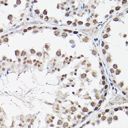 FOXO1/FOXO3/FOXO4 Polyclonal Antibody, Invitrogen&trade;