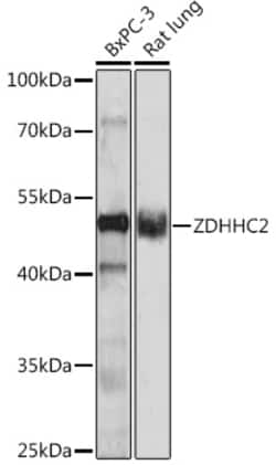 Invitrogen ZDHHC2 Polyclonal Antibody 100 &mu;L; Unconjugated:Antibodies,