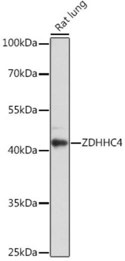Invitrogen ZDHHC4 Polyclonal Antibody 100 &mu;L; Unconjugated:Antibodies,