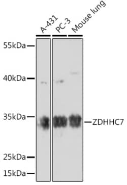 Invitrogen ZDHHC7 Polyclonal Antibody 100 &mu;L; Unconjugated:Antibodies,