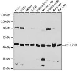 Invitrogen ZDHHC20 Polyclonal Antibody 100 &mu;L; Unconjugated:Antibodies,