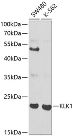 Invitrogen Kallikrein 1 Polyclonal Antibody 100 &mu;L; Unconjugated:Anticuerpos