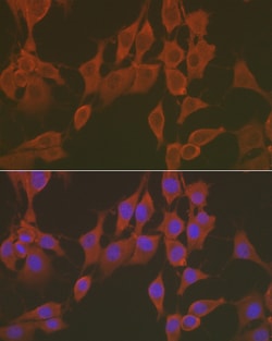 Invitrogen&trade;&nbsp;FNDC5 Polyclonal Antibody