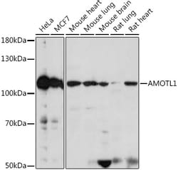 Invitrogen AMOTL1 Polyclonal Antibody 100 &mu;L; Unconjugated:Antibodies,