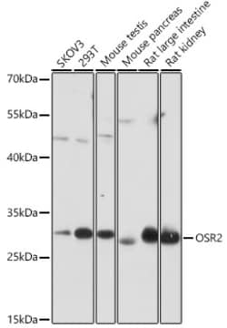 Invitrogen OSR2 Polyclonal Antibody 100 &mu;L; Unconjugated:Antibodies,