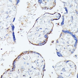 Invitrogen HSPB11 Polyclonal Antibody 100 &mu;L; Unconjugated:Antibodies,