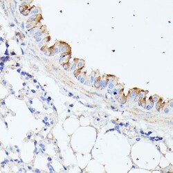 Invitrogen HSPB11 Polyclonal Antibody 100 &mu;L; Unconjugated:Antibodies,