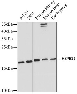 Invitrogen HSPB11 Polyclonal Antibody 100 &mu;L; Unconjugated:Antibodies,