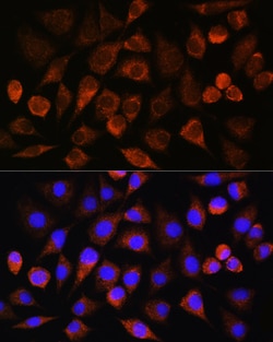 Invitrogen FAM5C Polyclonal Antibody 100 &mu;L; Unconjugated:Antibodies,
