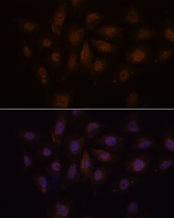 Invitrogen PCQAP Polyclonal Antibody 100 &mu;L; Unconjugated:Antibodies,