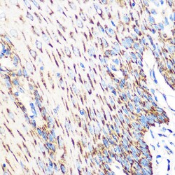 Invitrogen OSR1 Polyclonal Antibody 100 &mu;L; Unconjugated:Antibodies,