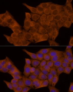 Invitrogen GSDMD Polyclonal Antibody 100 &mu;L; Unconjugated:Antibodies,
