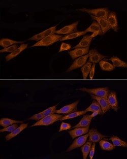 Invitrogen GSDMD Polyclonal Antibody 100 &mu;L; Unconjugated:Antibodies,