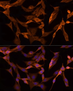 Invitrogen GSDMD Polyclonal Antibody 100 &mu;L; Unconjugated:Antibodies,
