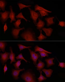 Invitrogen GSDMD Polyclonal Antibody 100 &mu;L; Unconjugated:Antibodies,
