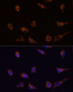 Invitrogen DIP2C Polyclonal Antibody 100 &mu;L; Unconjugated:Antibodies,