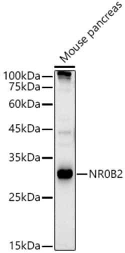 Invitrogen NR0B2 Polyclonal Antibody 100 &mu;L; Unconjugated:Antibodies,