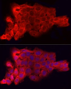 Invitrogen CD47 Polyclonal Antibody 100 &mu;L; Unconjugated:Antibodies,