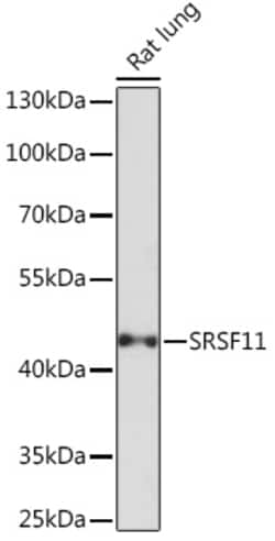 Invitrogen SRSF11 Polyclonal Antibody 100 &mu;L; Unconjugated:Antibodies,