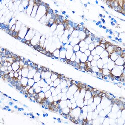 Invitrogen CABP1 Polyclonal Antibody 100 &mu;L; Unconjugated:Antibodies,