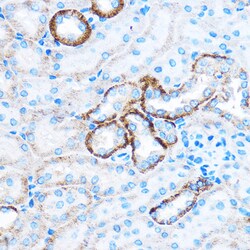 Invitrogen CABP1 Polyclonal Antibody 100 &mu;L; Unconjugated:Antibodies,