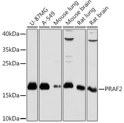 Invitrogen JM4 Polyclonal Antibody 100 μL; Unconjugated:Antibodies,